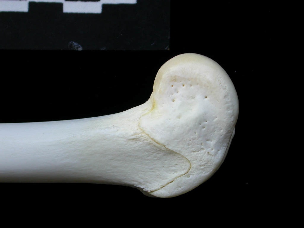 Femur: distal part