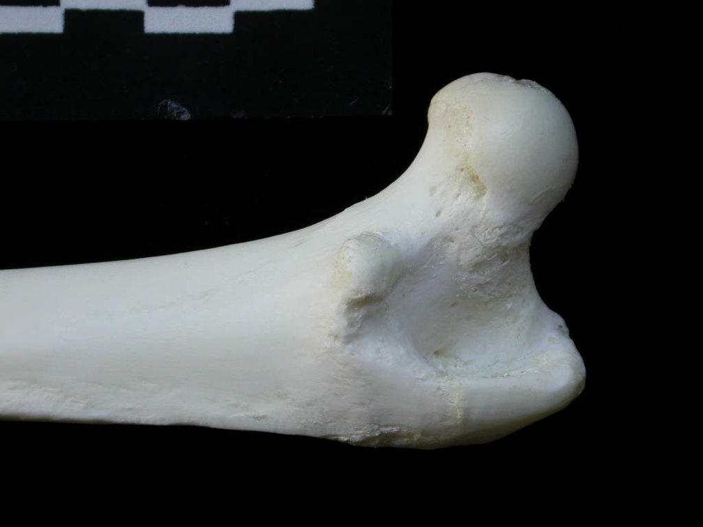 Femur: proximale part