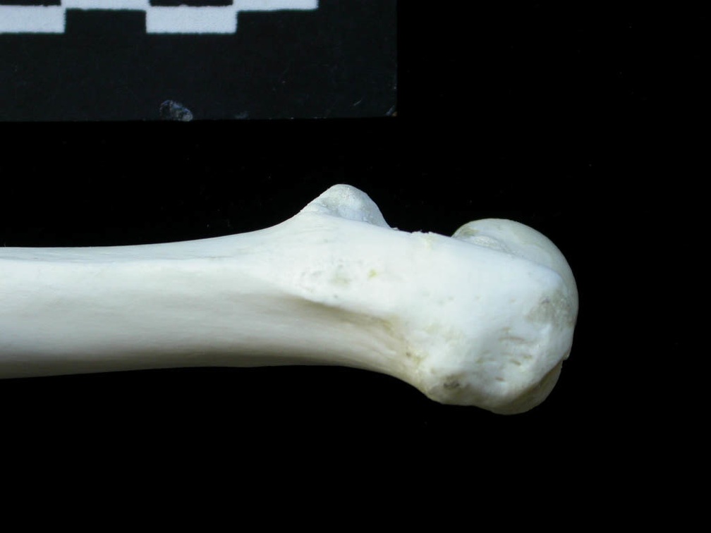 Femur: proximale part