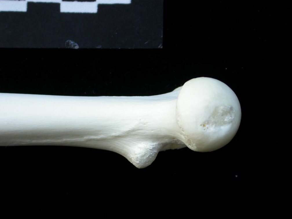 Femur: proximale part