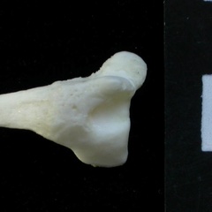 Fibula: distal part