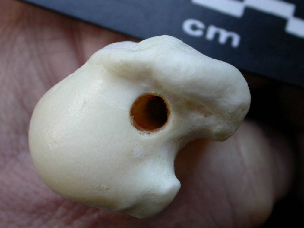 Humérus : extrémité proximale