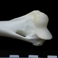 Humerus: distal part