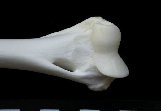 Humerus: distal part