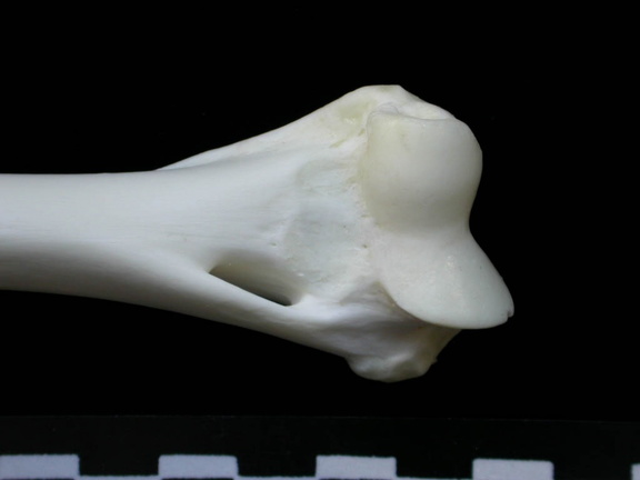 Húmero : parte distal