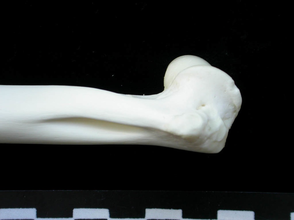 Humerus: distal part