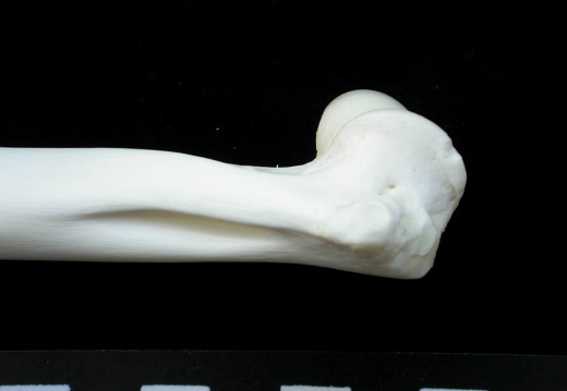 Humerus: distal part