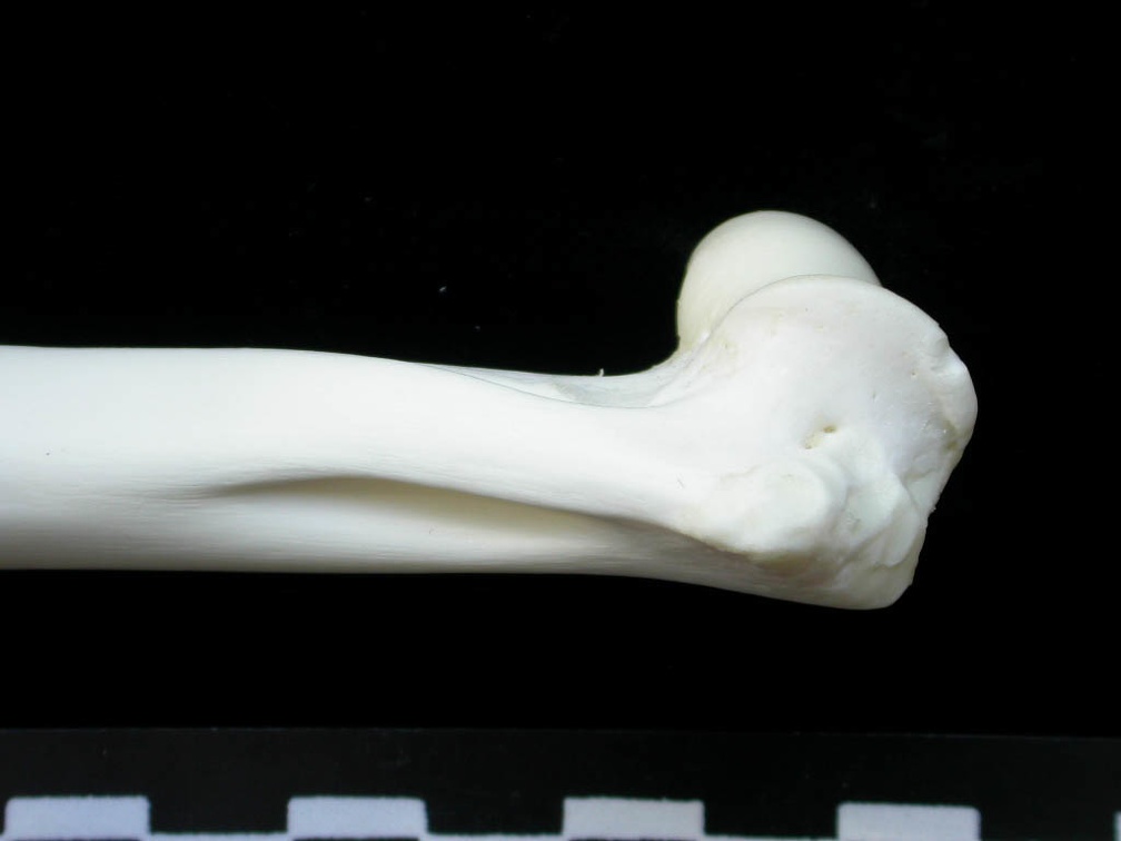 Humerus: distal part