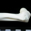 Humerus: distal part