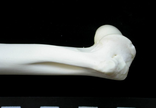 Humerus: distal part