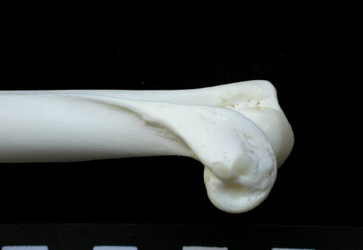 Humerus: distal part