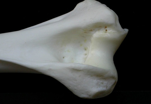 Humerus: distal part