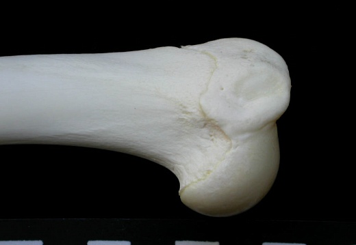 Humerus: proximale part