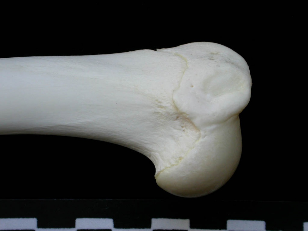 Humérus : partie proximale