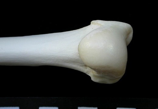 Humerus: proximale part