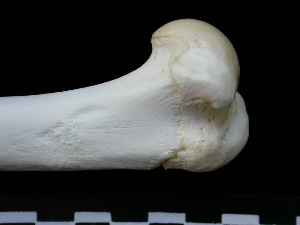 Humerus: proximale part