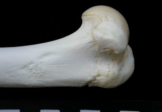 Humerus: proximale part