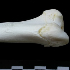 Humerus: proximale part