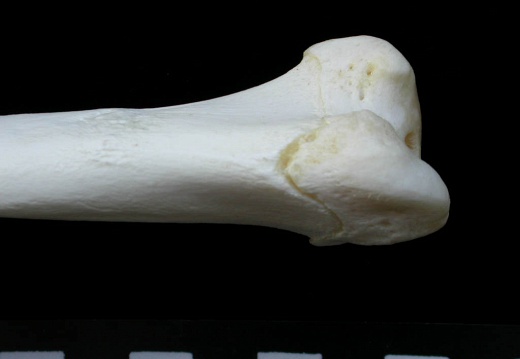 Humerus: proximale part