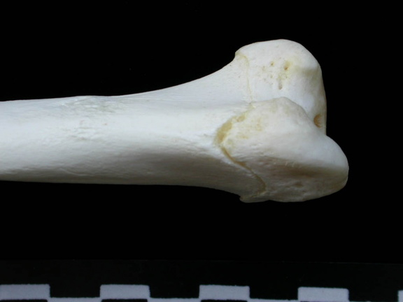 Húmero : parte proximal