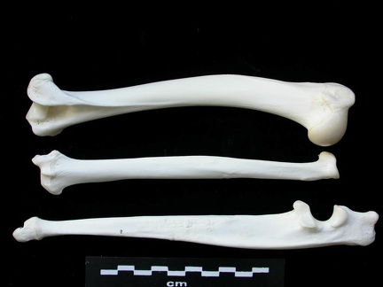 Humerus,radius and ulna