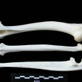 Humérus, radius et ulna