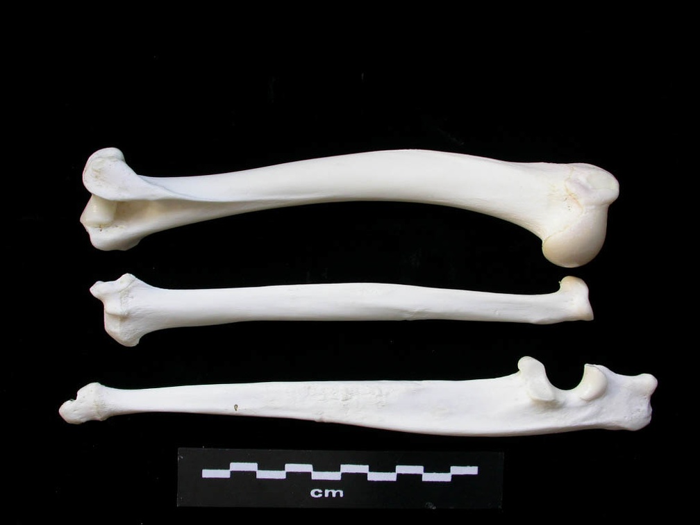 Humerus,radius and ulna