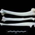 Humérus, radius et ulna