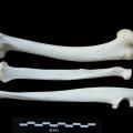 Humérus, radius et ulna