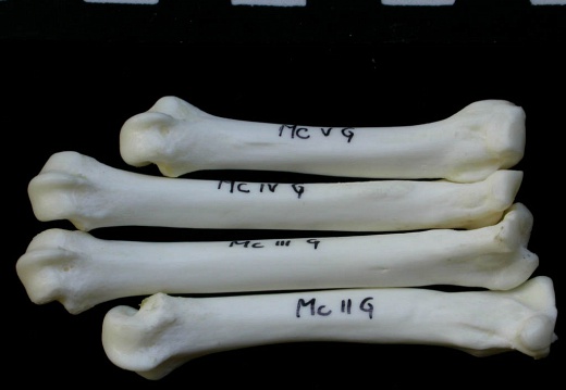 Metacarpals