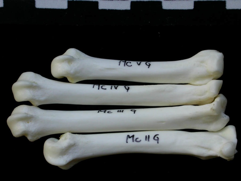 Metacarpals