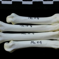 Metacarpals