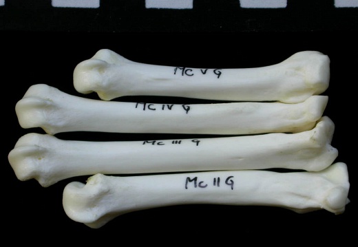 Metacarpals