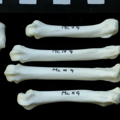 Metacarpals