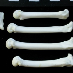 Metacarpals