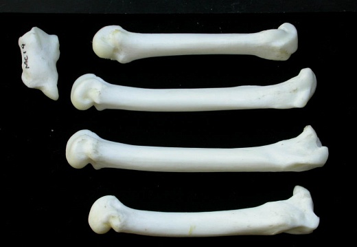 Metacarpals