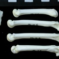 Metacarpals