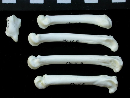 Metacarpals