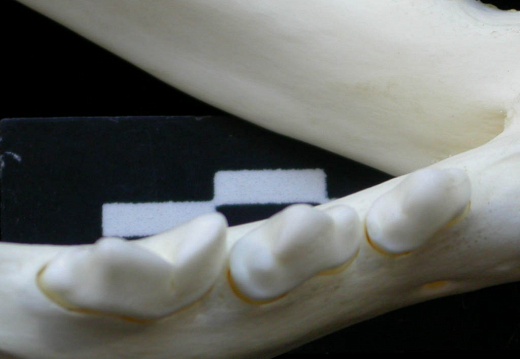 Lower teeth