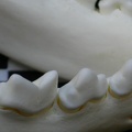 Dentition inférieure