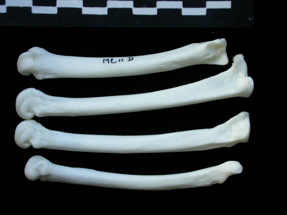 Métatarsiens