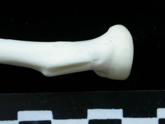 Radio : parte proximal