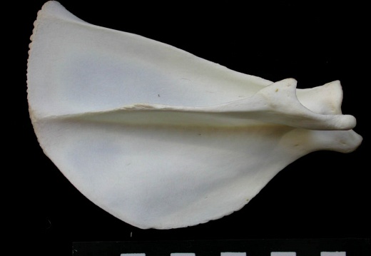 Scapula : vue latérale