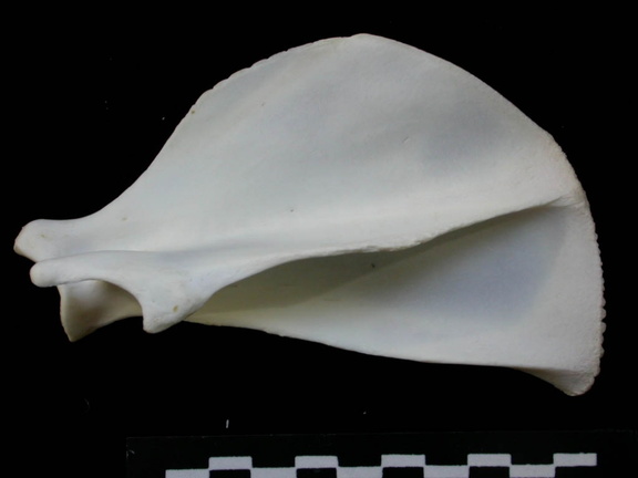 Escápula: vista lateral