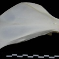 Scapula : vue médiale