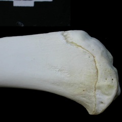  Tibia: proximale part