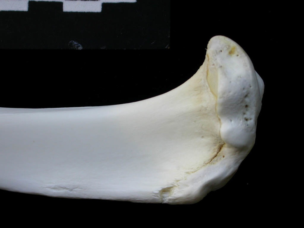  Tibia: proximale part