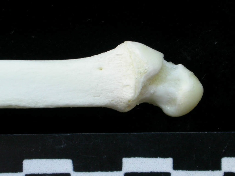  Ulna: distal part