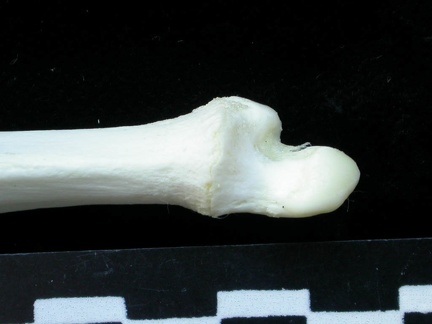 Ulna : partie distale