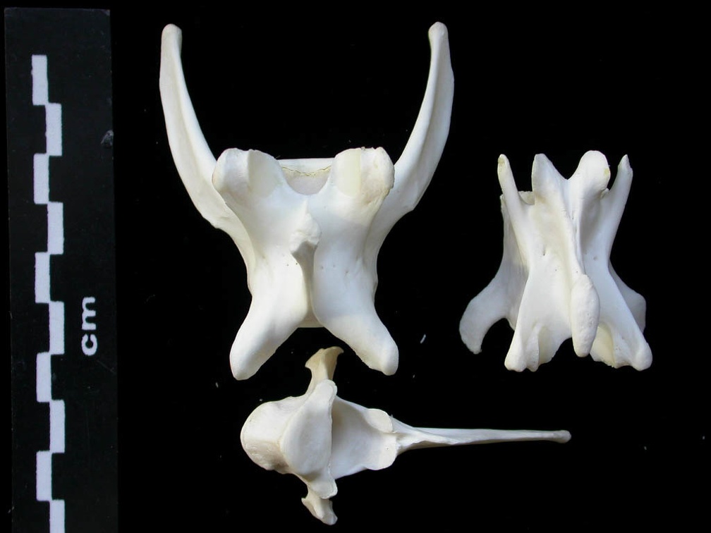 Vertebrae